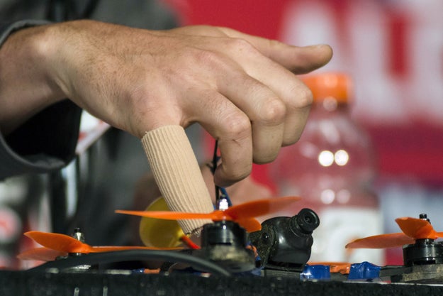 There are many ways you can get injured as a professional athlete, but a drone injury is usually not one of them. But for Trevor Bauer, a starting pitcher for the Cleveland Indians, it was, and he had to sit out Game 2 of the American League Championship Series on Saturday because of a badly cut pinky finer.