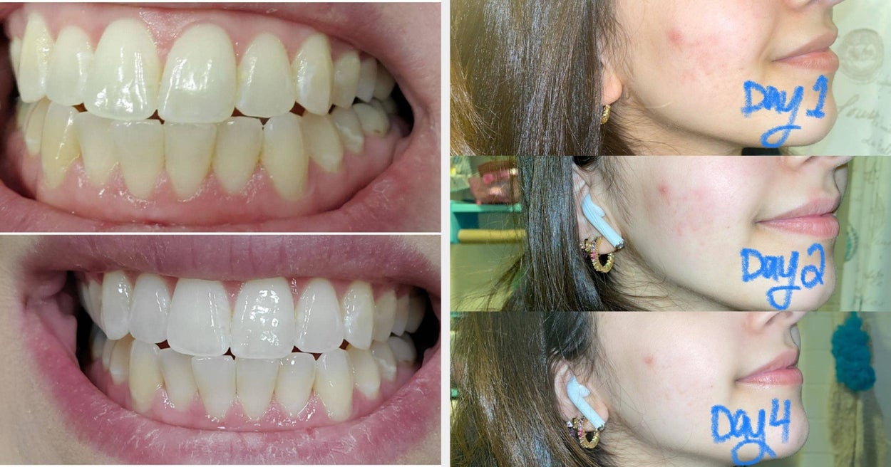 33 Products That Are Genuinely Transformative 1 33 Products That Are Genuinely Transformative