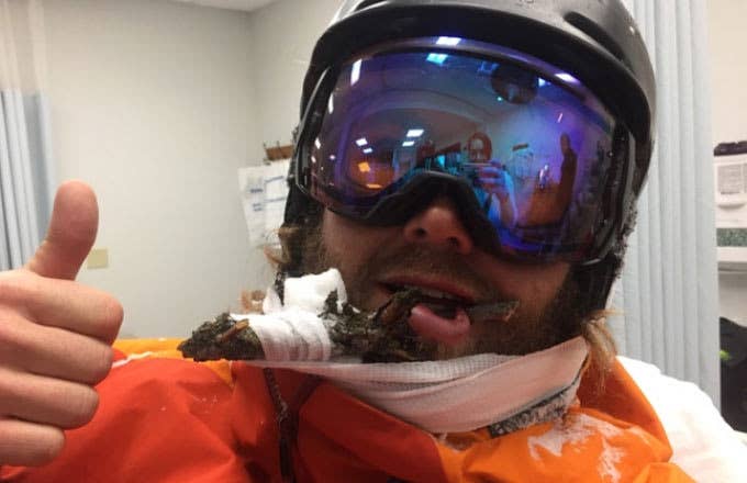 Snowboarder face impaled