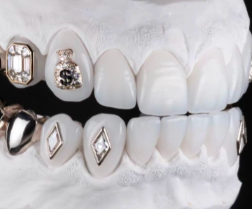 Moneybagg Yo&#x27;s new grill.