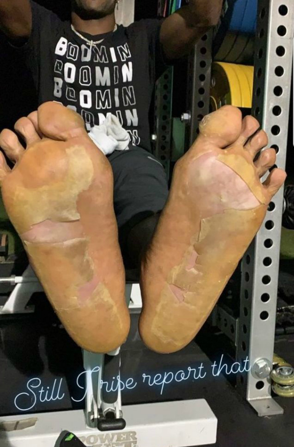 Antonio Brown feet