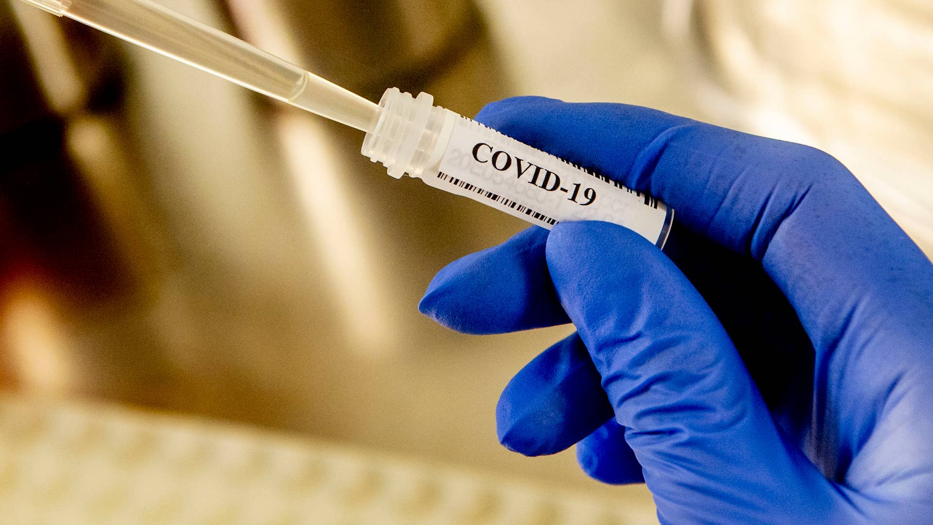 Lab technician holding blood sample test tube containing patient's positive COVID 19 test.