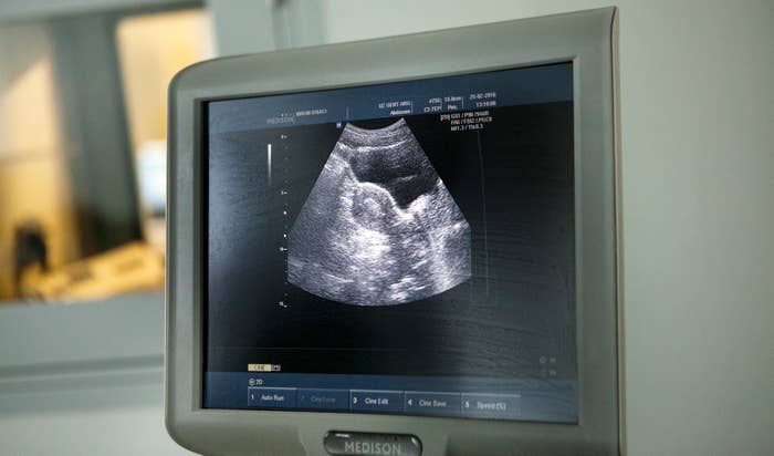 Ultrasound