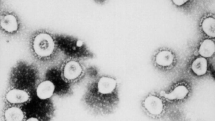 This undated handout photo from the CDC shows a microscopic view of the Coronavirus.