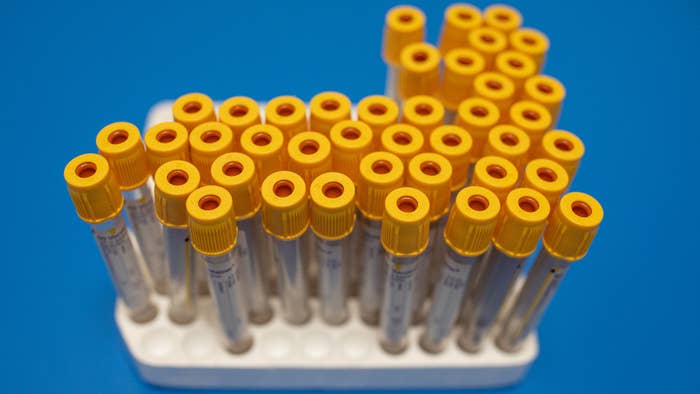 Test tubes to be used for blood samples sit on a table at an antibody testing program.