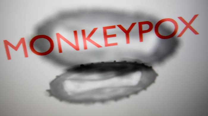 Monkeypox photo illustration from Getty