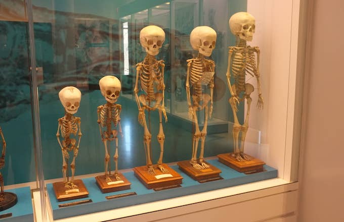 Skeletons of children from ages 3 months to 5 years.