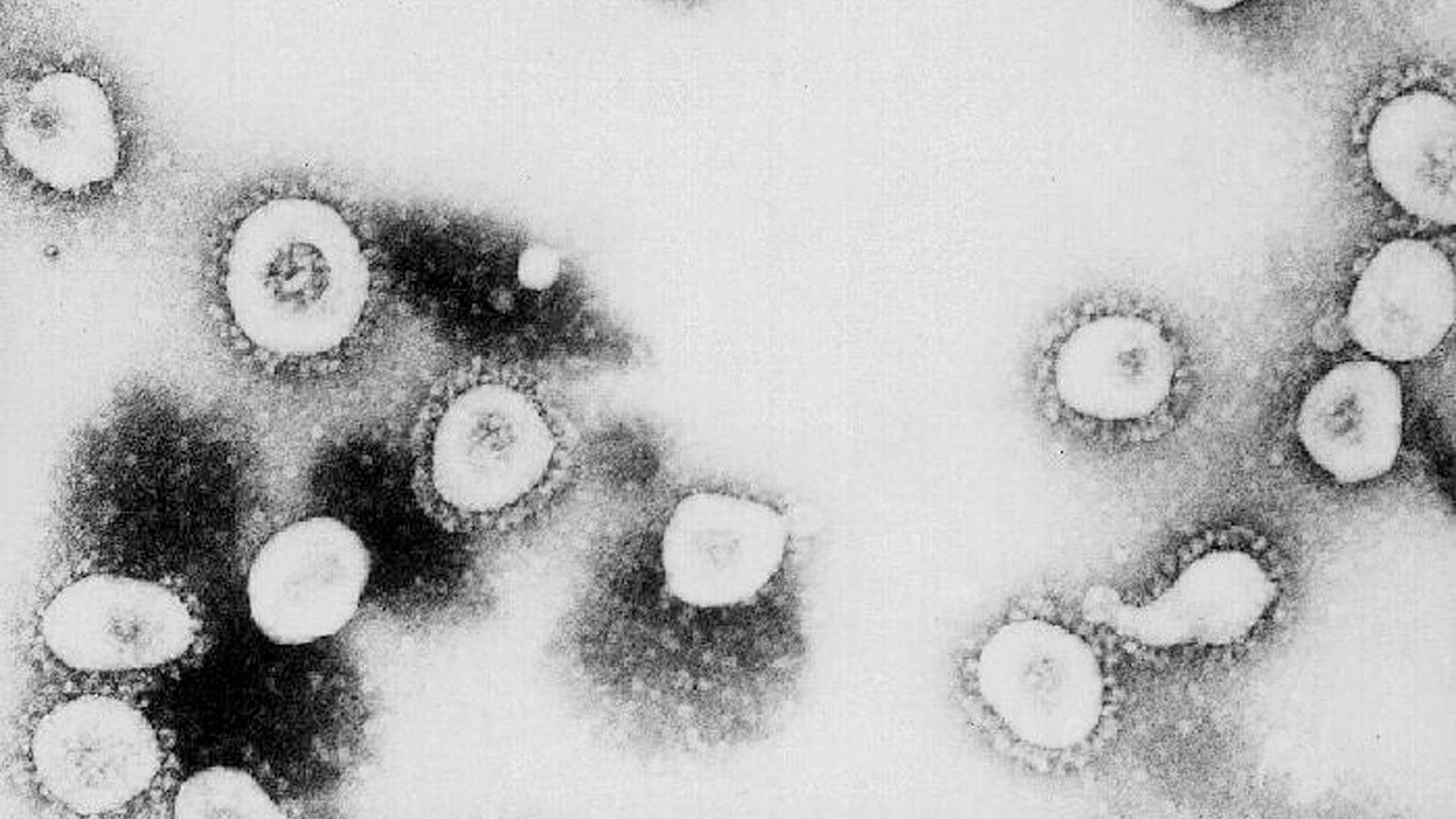 Microscopic view of the Coronavirus