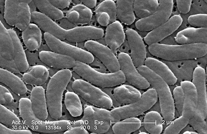 This is a photo of bacteria