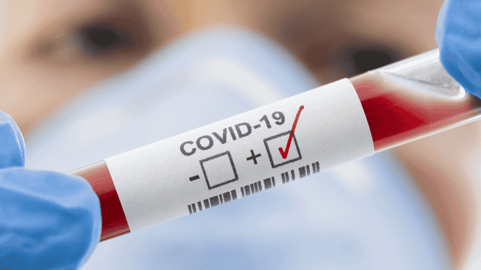 A positive test for COVID 19