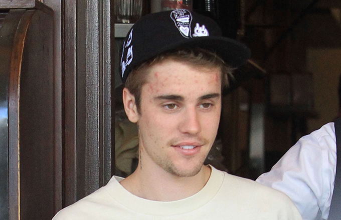 Justin Bieber Sued For Sharing Paparazzi Photo Of Himself On Instagram ...