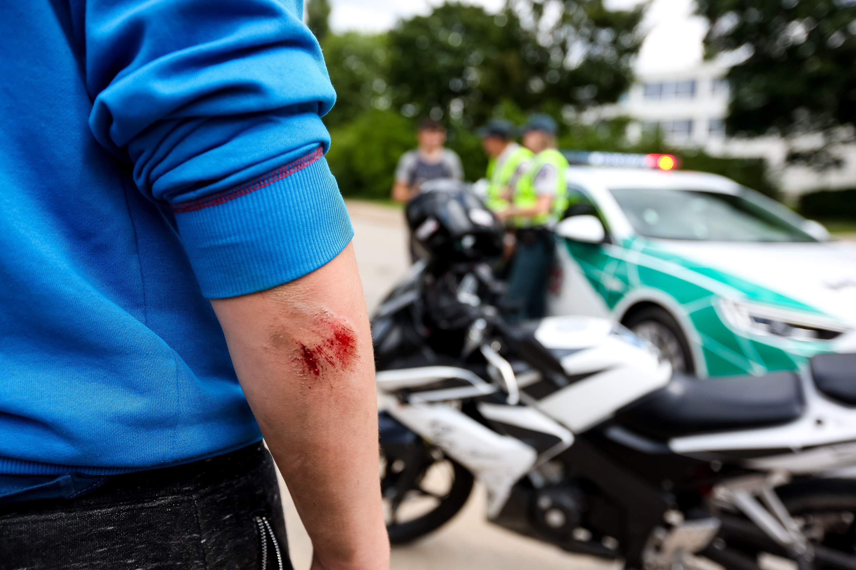 motorcycle injury