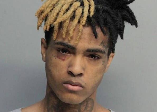 XXXTENTACION