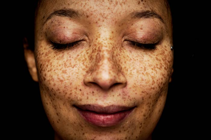 A woman with freckles, up close look at her face