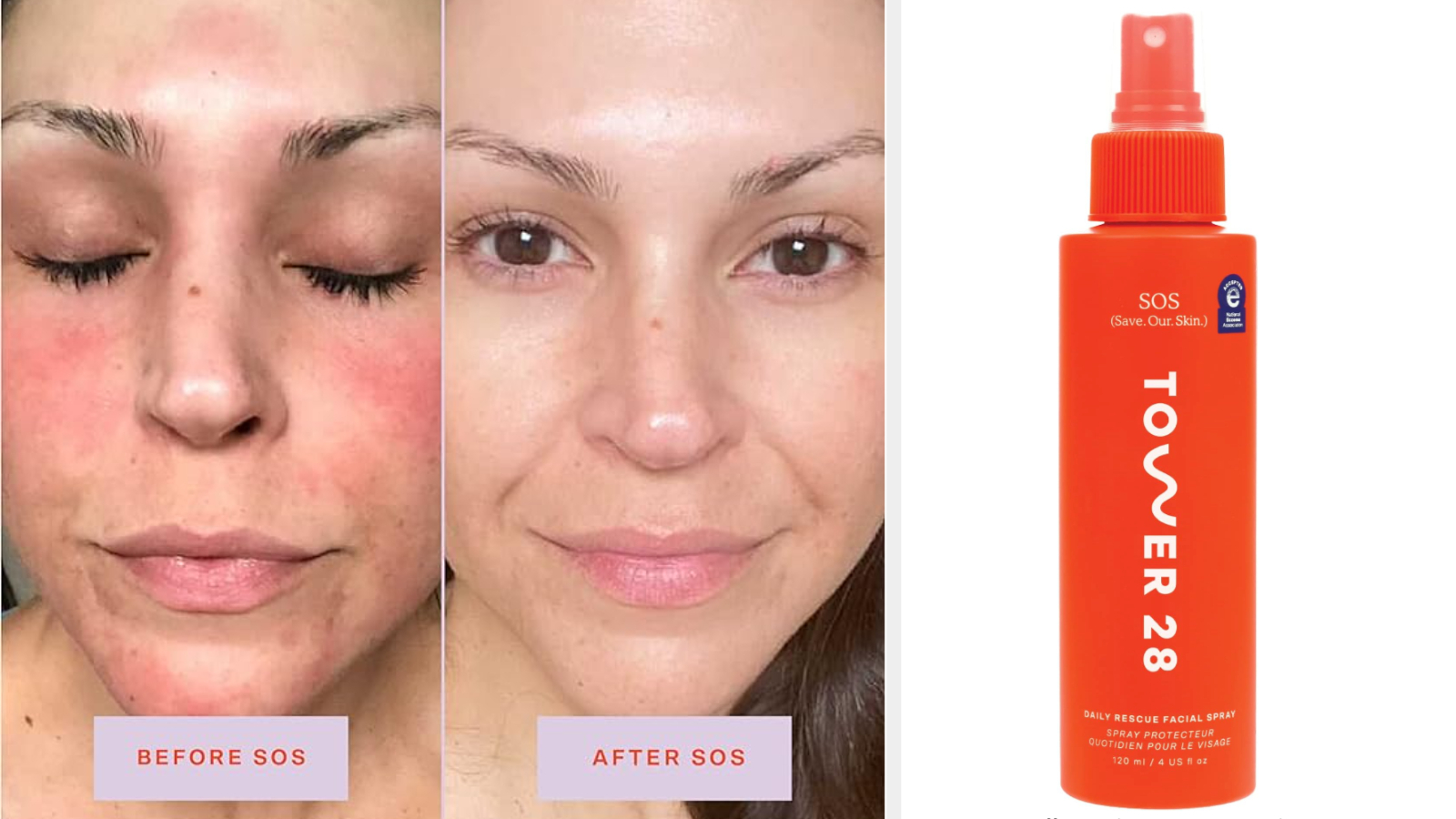 Before and after images of a person&#x27;s face following spray use, and a bottle of Tower 28 SOS facial spray