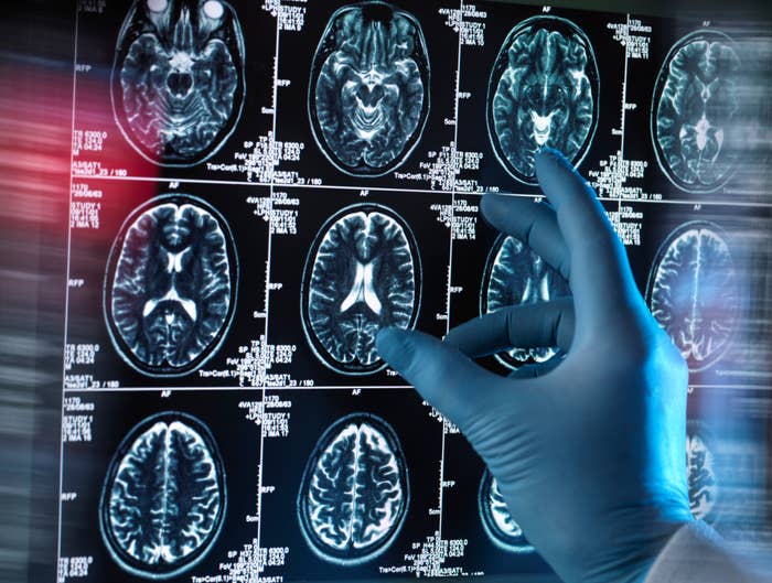 A gloved hand points at several brain scans on a screen showing different sections of the human brain in detailed images