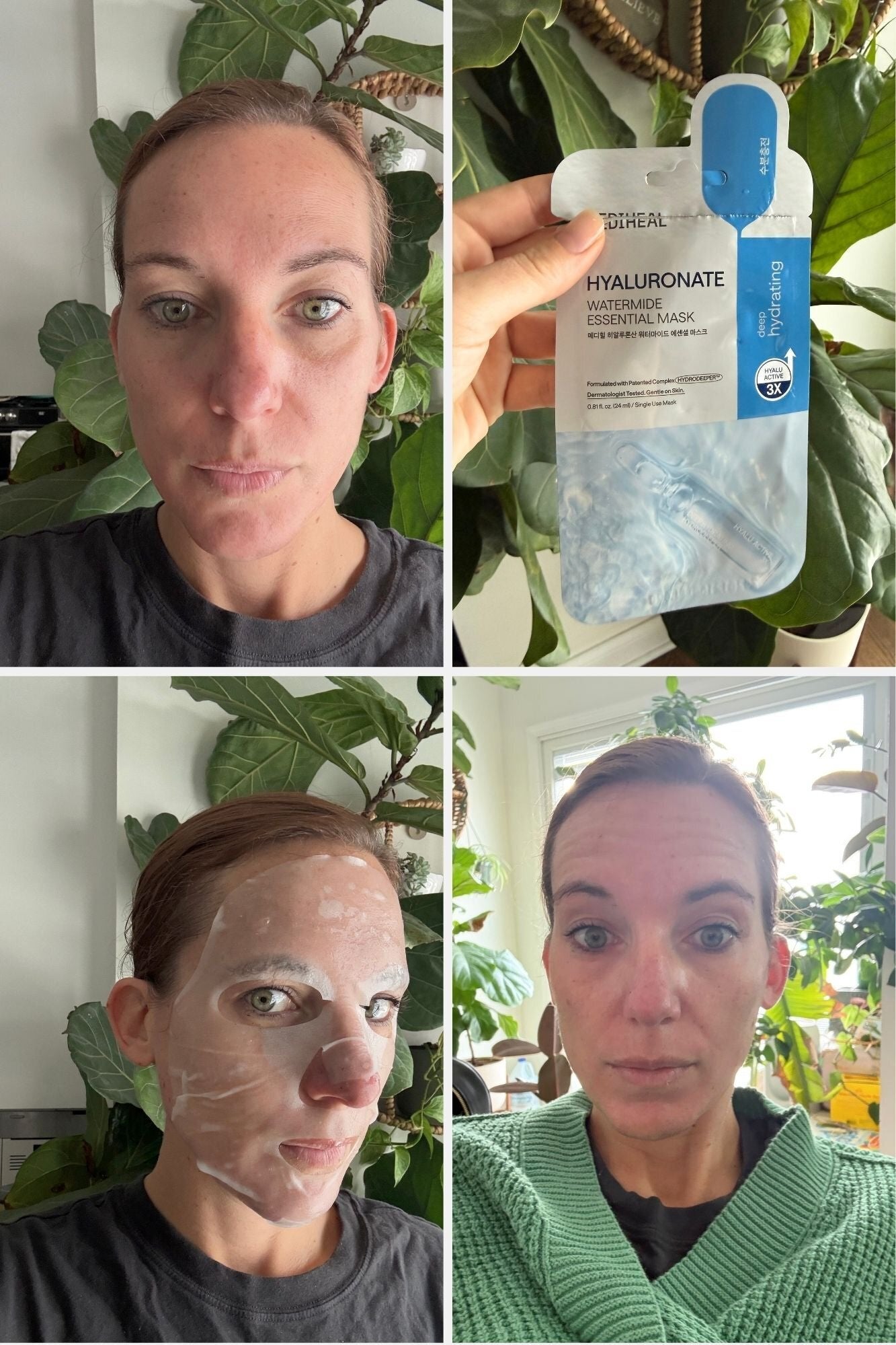 Author shows a hyaluronate essence disguise package, applies the mask, and reveals tegument earlier and aft usage successful a bid of 4 images