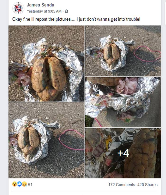 A man posts several pictures of a brain he says washed up on a beach.