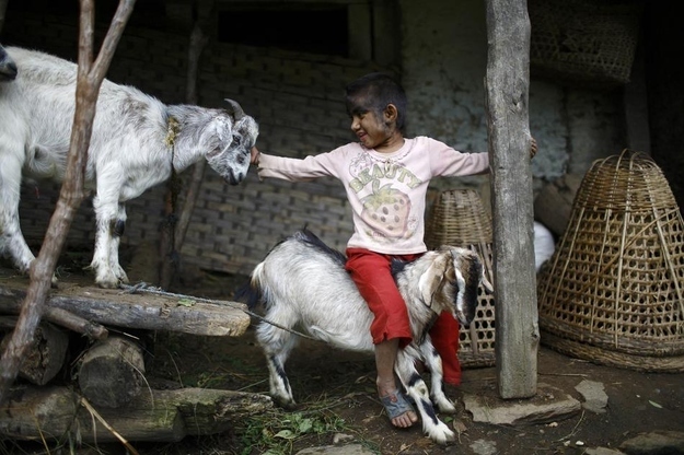 25 Incredible Images Of A Family Living With "Werewolf