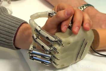 Man Gets Bionic Hand That Can Actually "Feel"