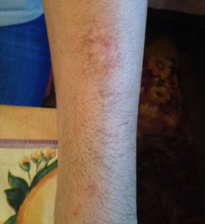 Flayed Alive In Uzbekistan, Frozen Out By Great Britain