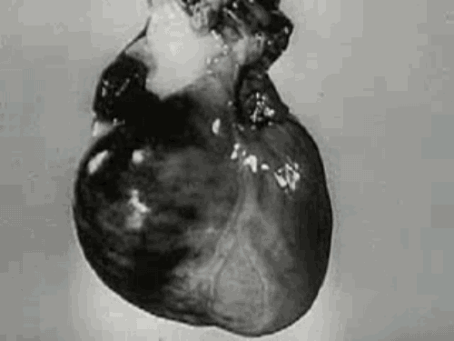 The heart of a vampire is supposedly where the demon lives that has turned them from human to vamp. CAREFULLY remove the heart and burn it to ash to kill them.