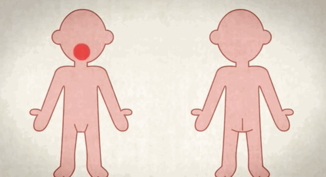 The above graphic teaches children which zones on their body are "unsafe" for somebody else to touch.