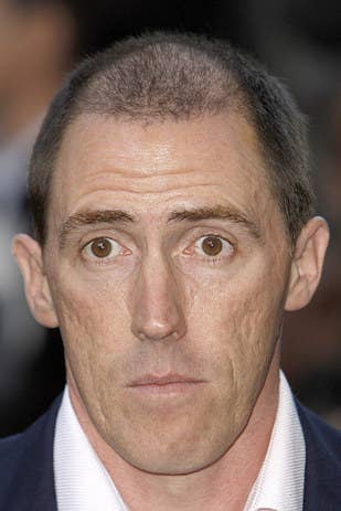 42 Celebrity Men Who Are Less Bald Than They Used To Be