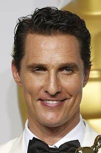 which celebrity has hair transplant