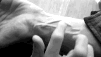You are a Master of Vascular.