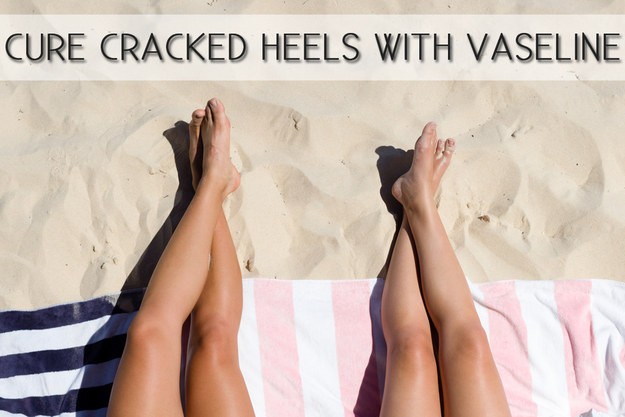 For cracked dry feet, use Vaseline and cotton socks for an overnight miracle.