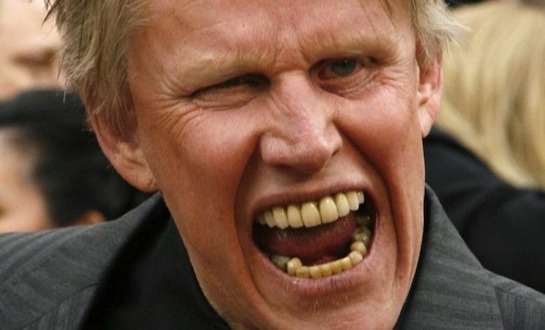 Gary Busey – Gary’s starred in well over 100 movies including big hits like Lethal Weapon and Point Break. One look at this photo suggests his agent ought to be looking for a big-time zombie role next. He’s a natural.