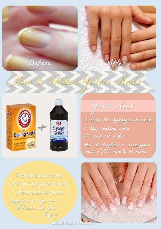 If you don't want to bother getting a full manicure (and who does?), you can easily clean up your nails with this simple recipe.