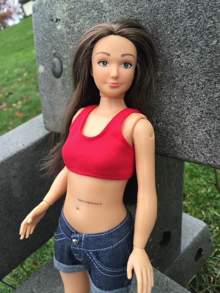 barbie with acne