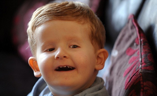 15 People With Extra Limbs & Body Parts