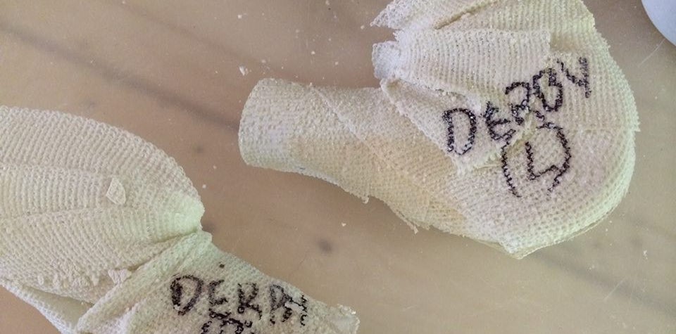 Positive molds of Derby's elbows for the prosthetics.
