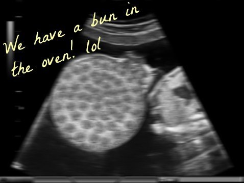 You didn't really need to see the pizza baby or where it's growing THAT closely, tbh.