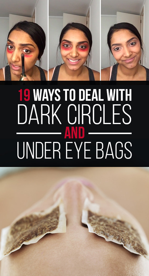 Bags Under Eyes Symptoms and How to get rid of