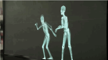 x ray skeleton kiss