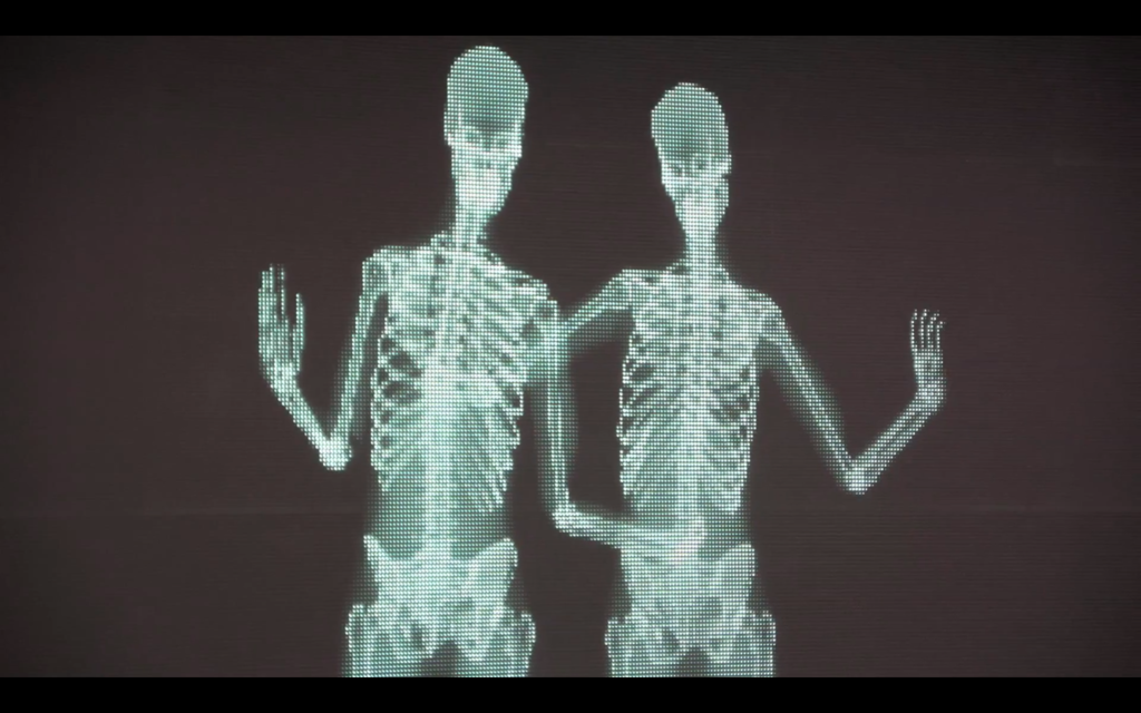 x ray skeleton kiss