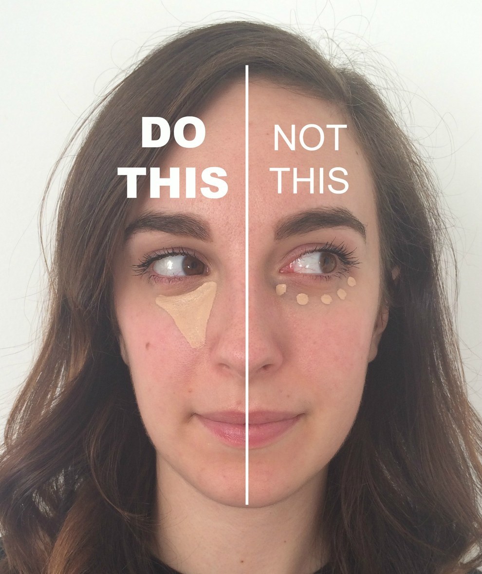 Skuffelse Australsk person Hjemland 19 Ways To Deal With Dark Circles And Under-Eye Bags