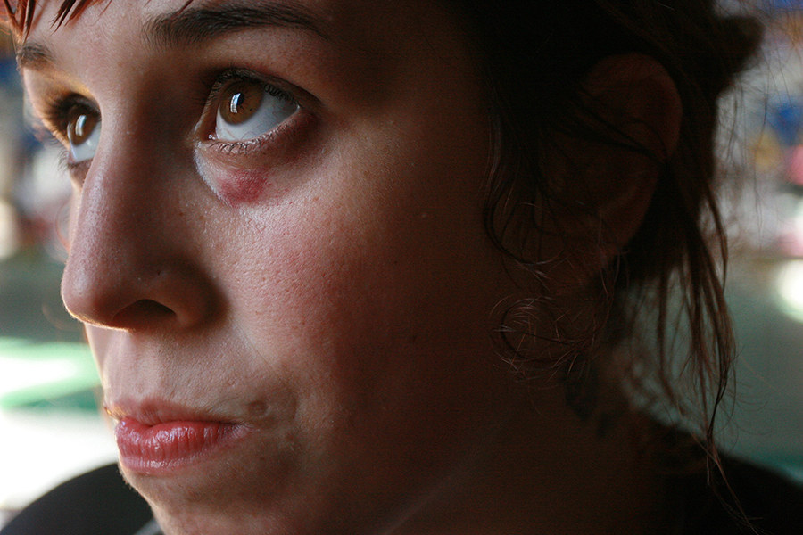 "You're proud if you've earned it. It's like a battle scar," says Cohen. It might be a little strange to explain the first time, but once your friends and co-workers know you're a fighter, they'll stop questioning your bumps and bruises.