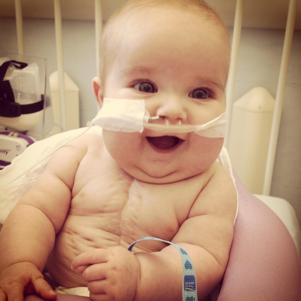 According to Caters News, he has had four open heart surgeries and five operations, suffered a stroke and has had to be resuscitated three times.