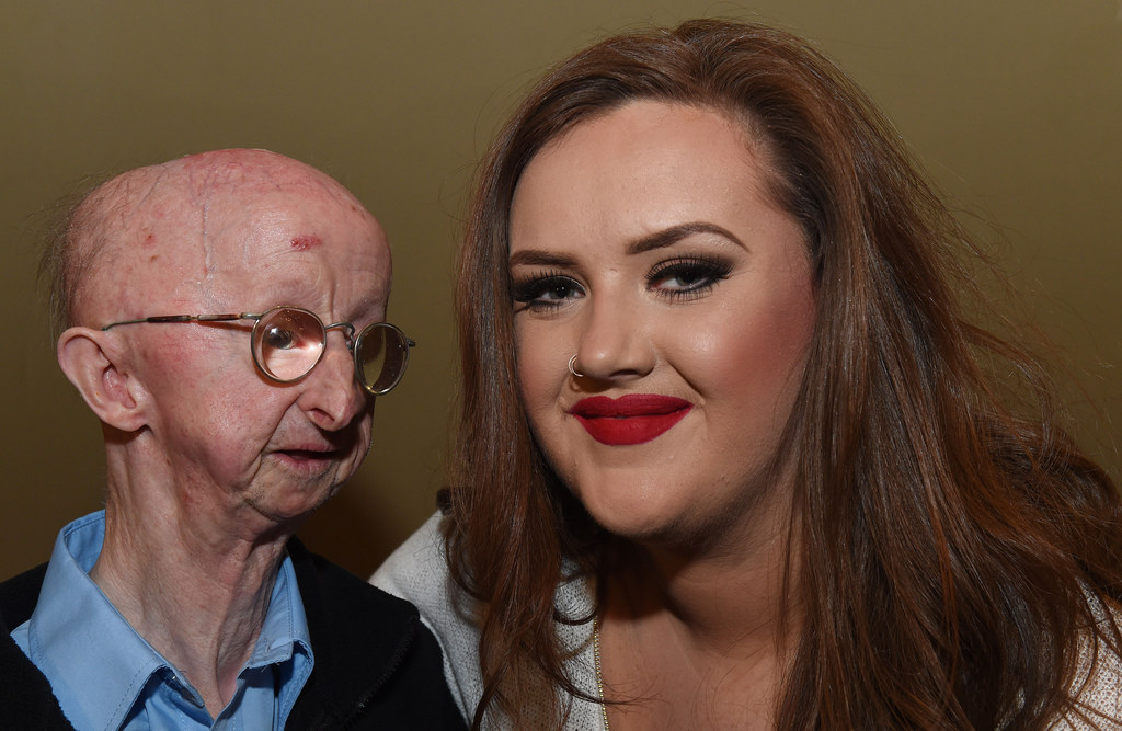 He's known locally as a skilled mathematician who impresses young people by working out how many days a person has been alive after being told their date of birth. He had an emotional meeting with Katie Cutler in February this year, and said: "I am totally overwhelmed and incredibly grateful to Katie for what she has done for me. The youth of today don't always get portrayed in a positive light, but I won't ever forget what this young woman has done for me. This is the best thing that has ever happened to me."He told the press he was going to use some of the £300,000 to buy a home closer to where she lived.