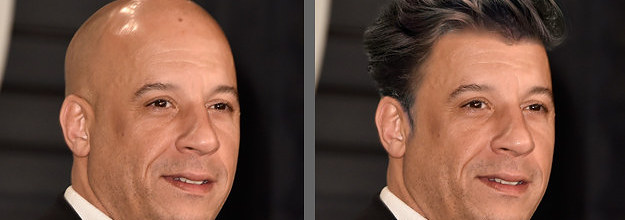 38 Photos of Bald Celebrities When They Had Hair – Bald Actors