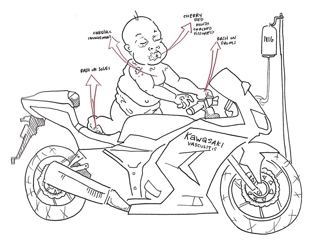 Откуда мем кавасаки кого крико и истрипер. Kawasaki мемы. Кавасаки ниндзя приколы. Кавасаки курсач.