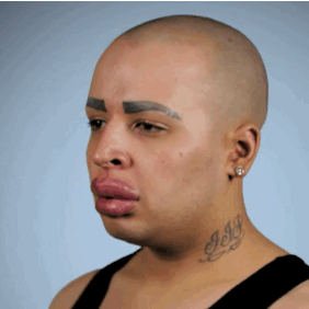 This Guy Spent $150,000 To Look Like Kim Kardashian And Now His Lips ...