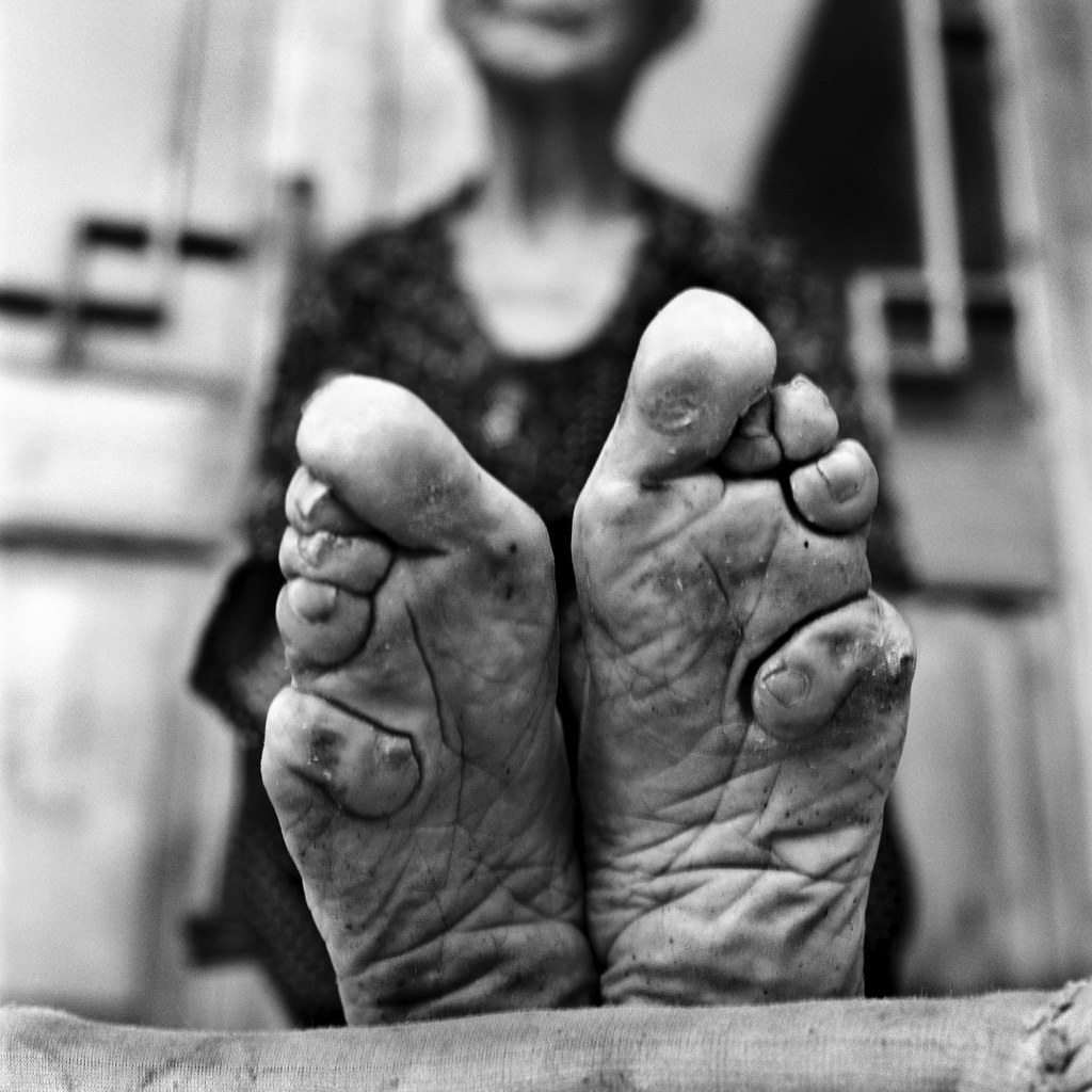 19 Photos Of The Last Surviving Chinese Women With Bound Feet