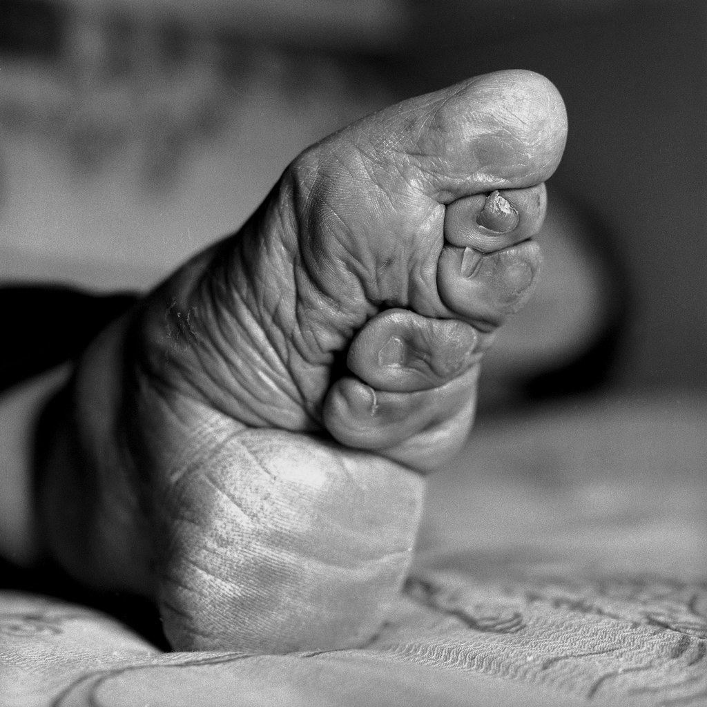 Foot Binding - Young girls in 1930s China having their feet bound to modify ...