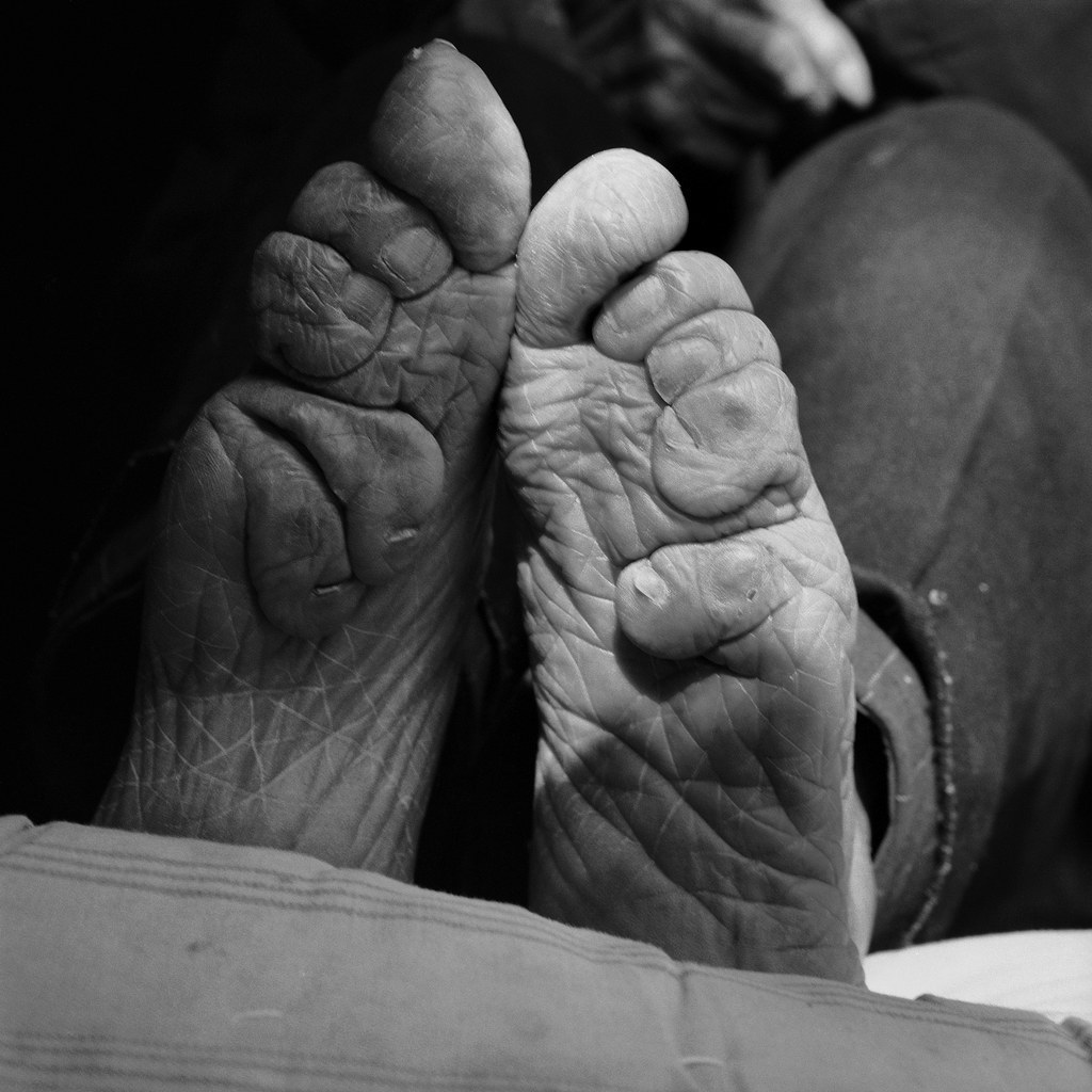 19 Photos Of The Last Surviving Chinese Women With Bound Feet